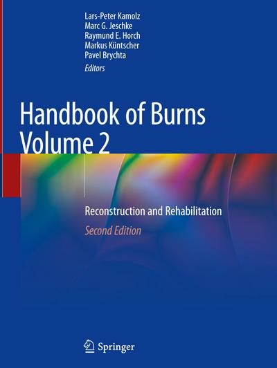 Handbook of Burns Volume 2