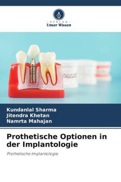 Prothetische Optionen in der Implantologie