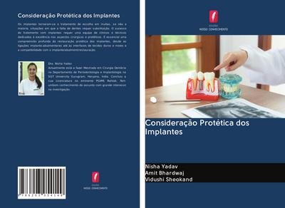 Consideração Protética dos Implantes