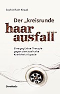 Der kreisrunde Haarausfall