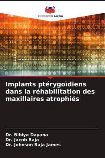 Implants ptérygoïdiens dans la réhabilitation des maxillaires atrophiés