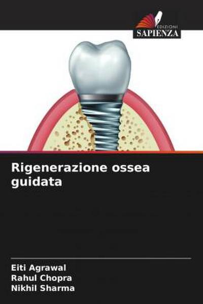 Rigenerazione ossea guidata