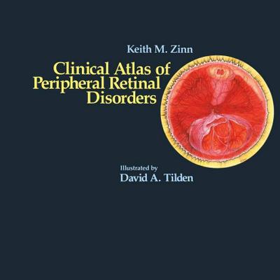 Clinical Atlas of Peripheral Retinal Disorders