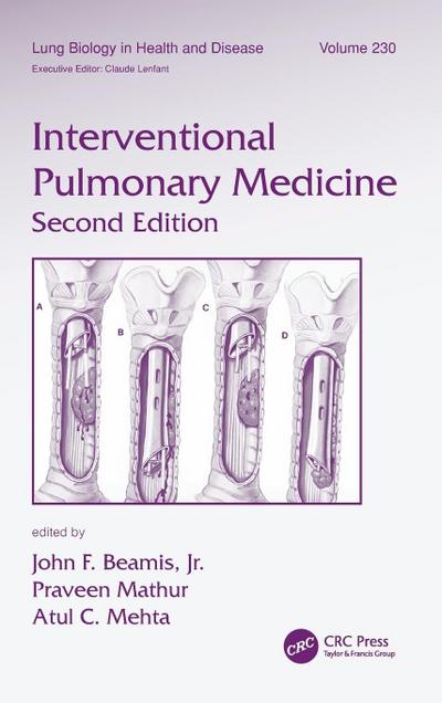 Interventional Pulmonary Medicine