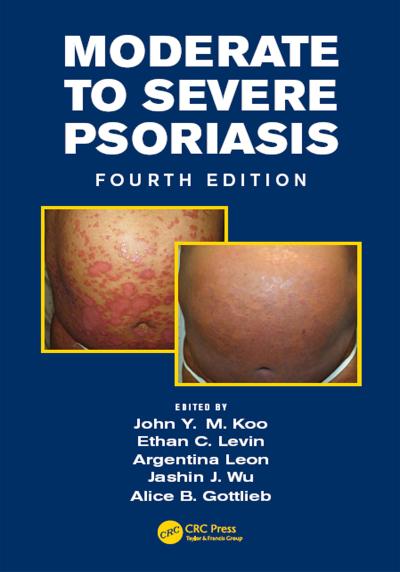 Moderate to Severe Psoriasis