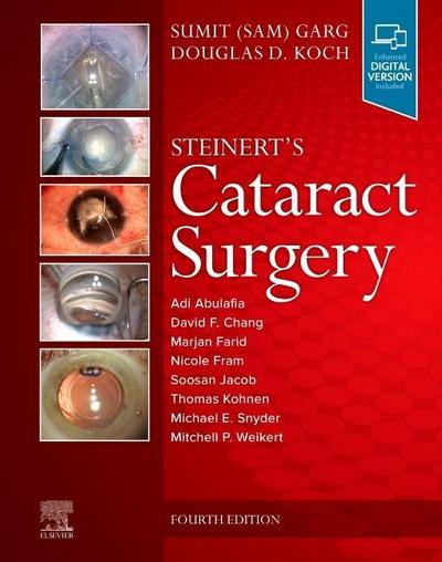 Steinert’s Cataract Surgery