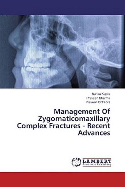 Management Of Zygomaticomaxillary Complex Fractures - Recent Advances