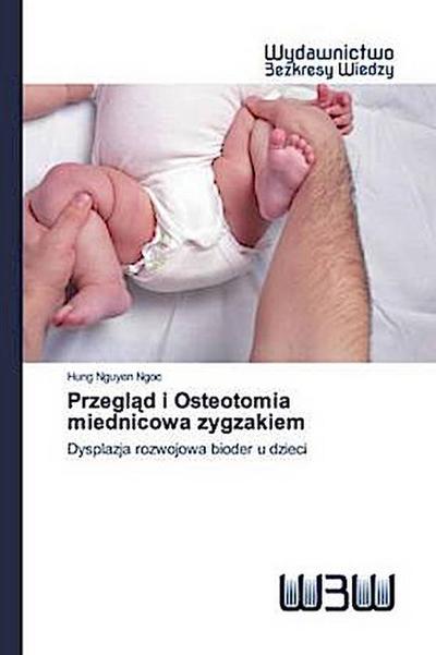 Przegl¿d i Osteotomia miednicowa zygzakiem