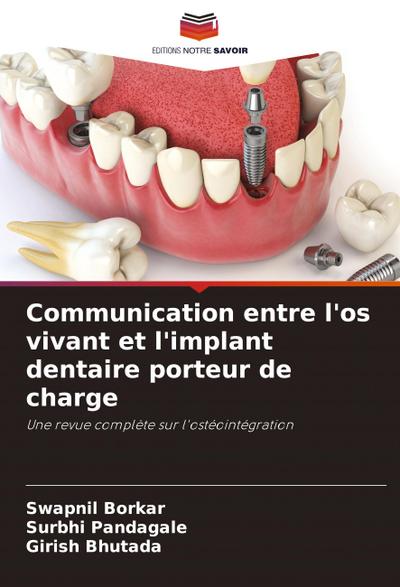 Communication entre l’os vivant et l’implant dentaire porteur de charge