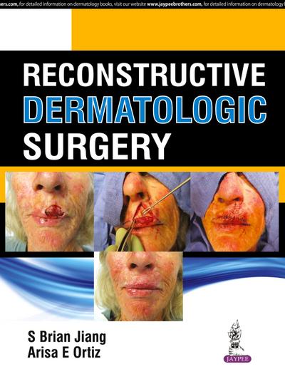 Reconstructive Dermatologic Surgery