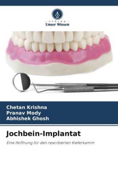 Jochbein-Implantat