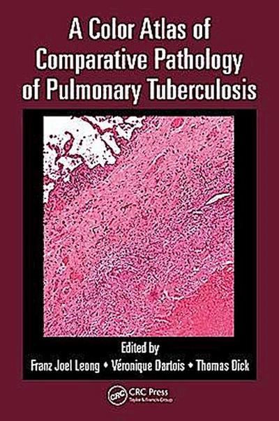 Leong, F: Color Atlas of Comparative Pathology of Pulmonary