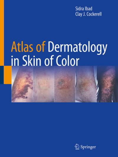 Atlas of Dermatology in Skin of Color