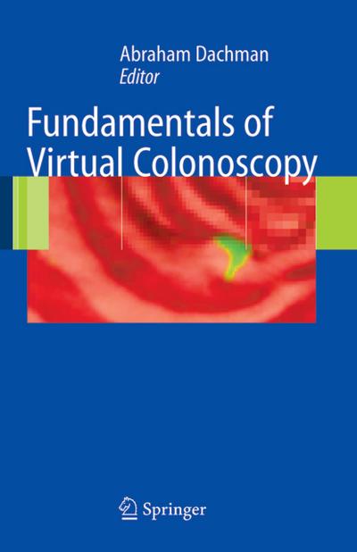 Fundamentals of Virtual Colonoscopy