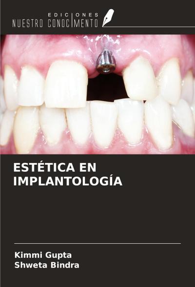 ESTÉTICA EN IMPLANTOLOGÍA