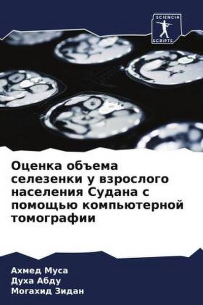 Ocenka ob#ema selezenki u wzroslogo naseleniq Sudana s pomosch’ü komp’üternoj tomografii