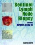 Sentinel Lymph Node Biopsy