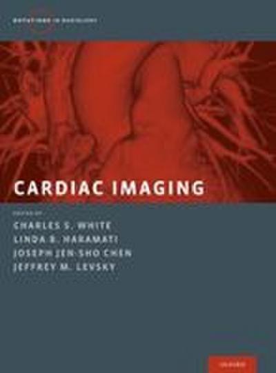 Cardiac Imaging