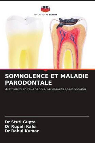SOMNOLENCE ET MALADIE PARODONTALE