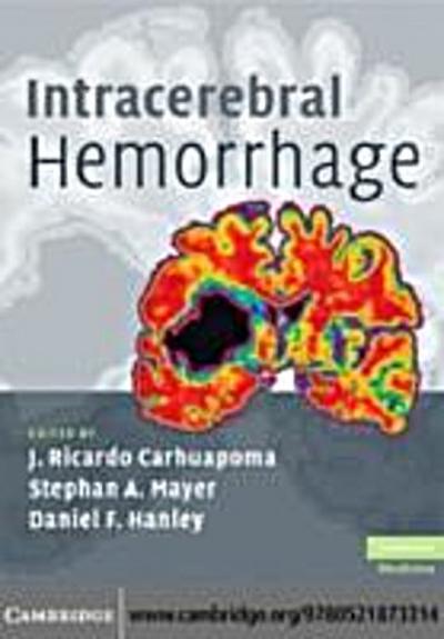 Intracerebral Hemorrhage