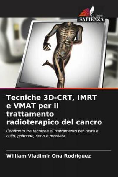 Tecniche 3D-CRT, IMRT e VMAT per il trattamento radioterapico del cancro