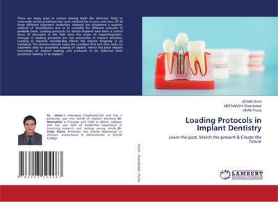 Loading Protocols in Implant Dentistry