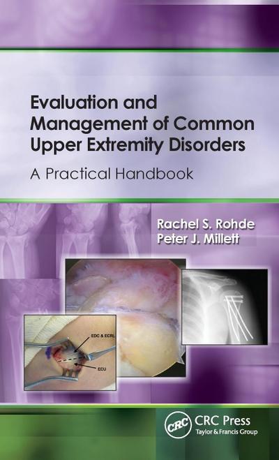 Evaluation and Management of Common Upper Extremity Disorders