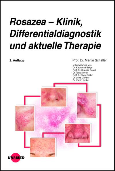 Rosazea - Klinik, Differentialdiagnostik und aktuelle Therapie
