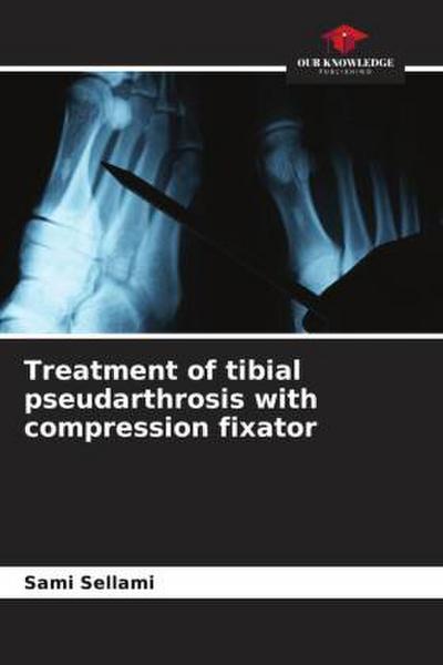 Treatment of tibial pseudarthrosis with compression fixator
