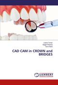 CAD CAM in CROWN and BRIDGES