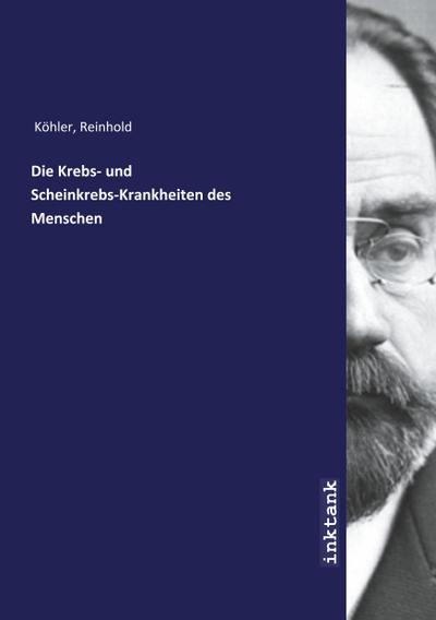 Die Krebs- und Scheinkrebs-Krankheiten des Menschen