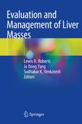 Evaluation and Management of Liver Masses