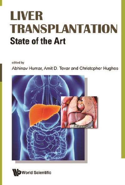 LIVER TRANSPLANTATION: STATE OF THE ART