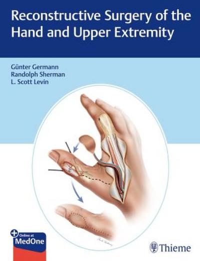 Reconstructive Surgery of the Hand and Upper Extremity
