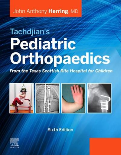 Tachdjian’s Pediatric Orthopaedics: From the Texas Scottish Rite Hospital for Children E-Book