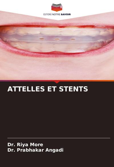 ATTELLES ET STENTS