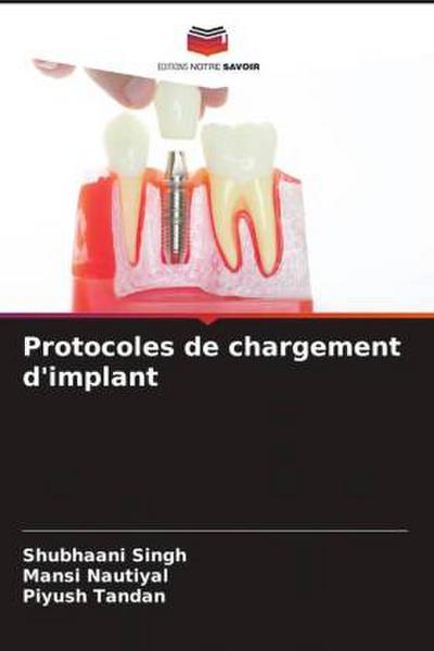 Protocoles de chargement d’implant