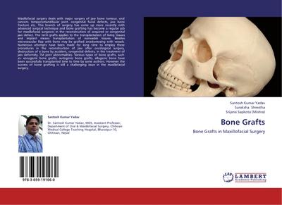 Bone Grafts