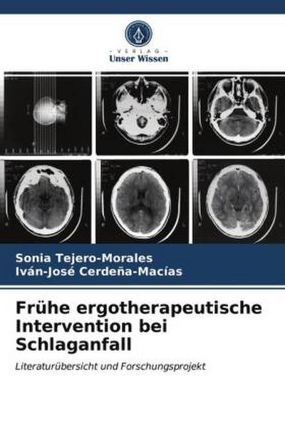 Frühe ergotherapeutische Intervention bei Schlaganfall