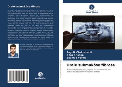 Orale submuköse fibrose