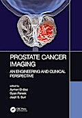 Prostate Cancer Imaging