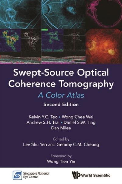 SWEPT-SOURCE OPTIC COHE (2ND ED)
