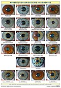 Konstitutionsorientierte Irisdiagnose, Wandtafel