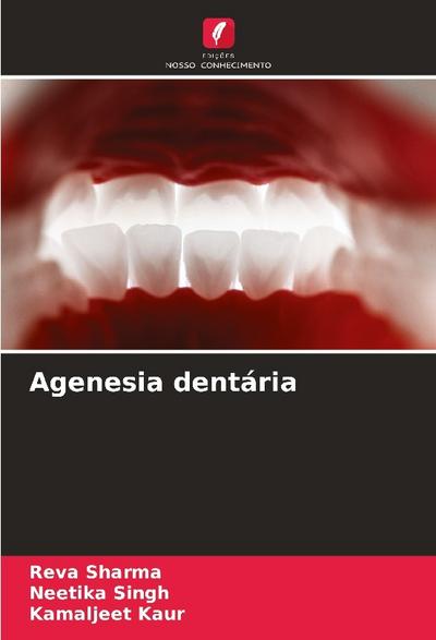 Agenesia dentária