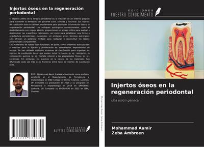 Injertos óseos en la regeneración periodontal
