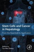 Stem Cells and Cancer in Hepatology