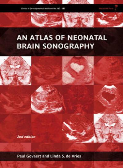 An Atlas of Neonatal Brain Sonography