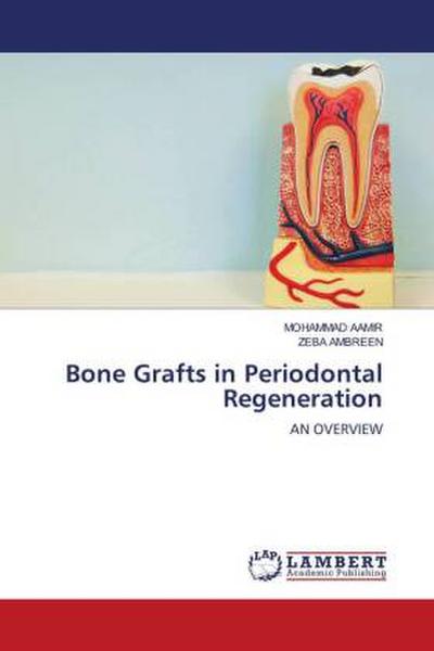 Bone Grafts in Periodontal Regeneration