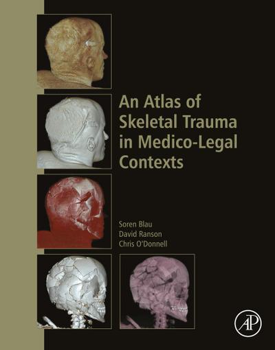 An Atlas of Skeletal Trauma in Medico-Legal Contexts