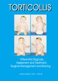 Torticollis